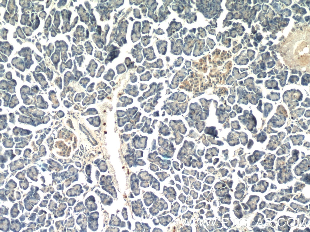 Immunohistochemistry (IHC) staining of human pancreas tissue using AOAH Polyclonal antibody (12911-1-AP)