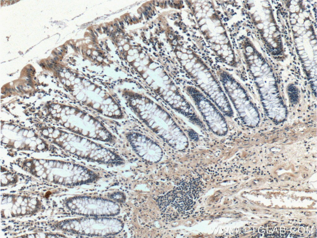 Immunohistochemistry (IHC) staining of human colon tissue using AOAH Polyclonal antibody (12911-1-AP)