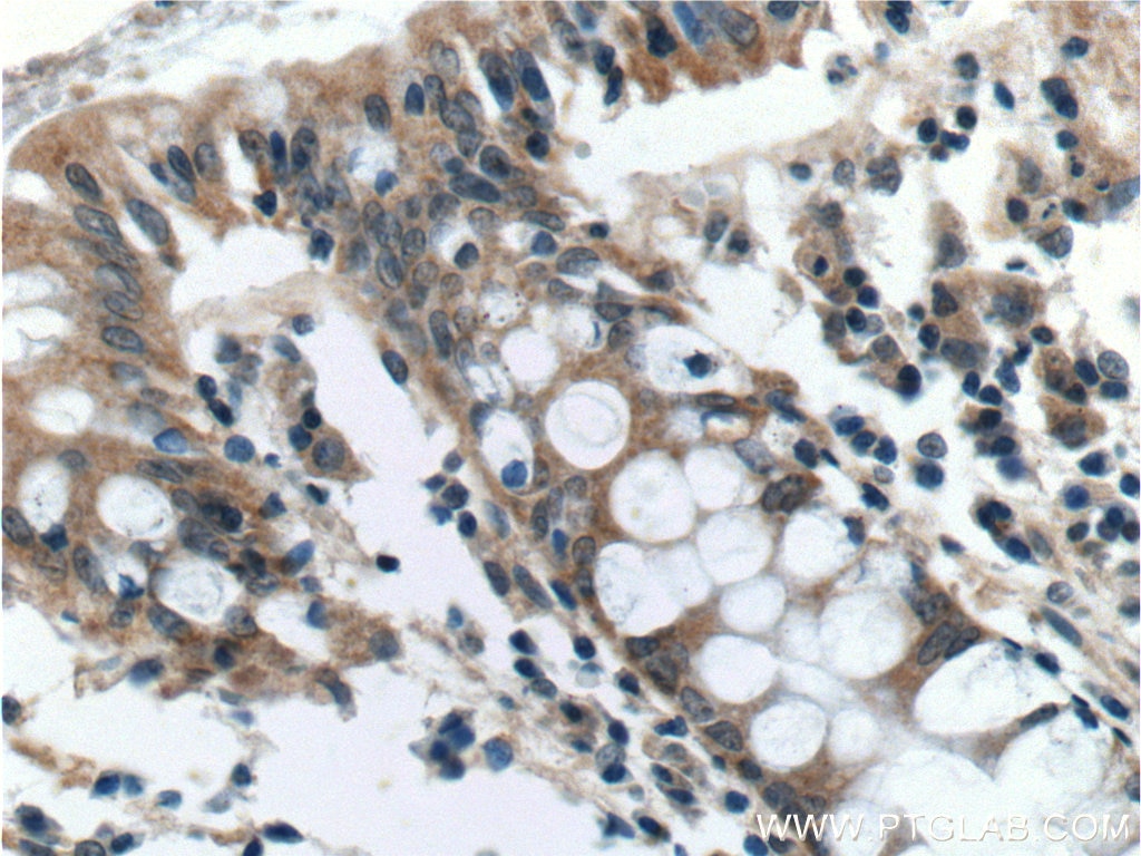 Immunohistochemistry (IHC) staining of human colon tissue using AOAH Polyclonal antibody (12911-1-AP)