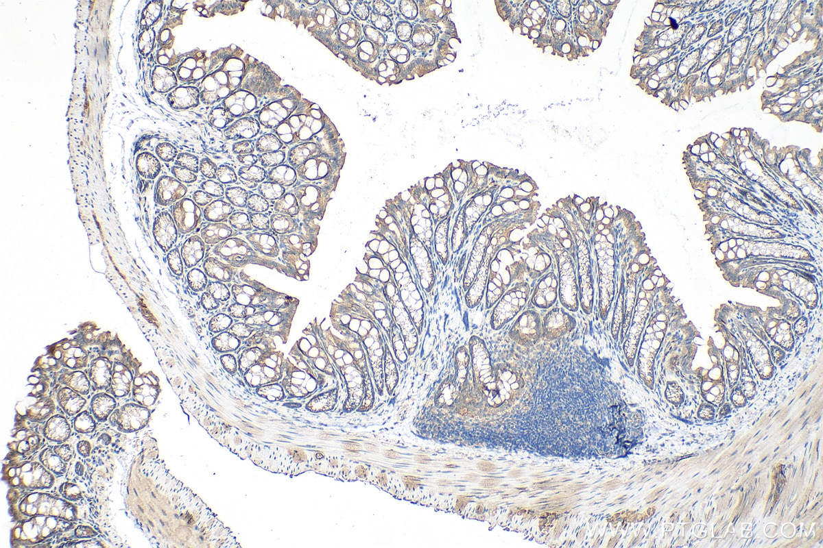 Immunohistochemistry (IHC) staining of mouse colon tissue using AOAH Polyclonal antibody (12911-1-AP)