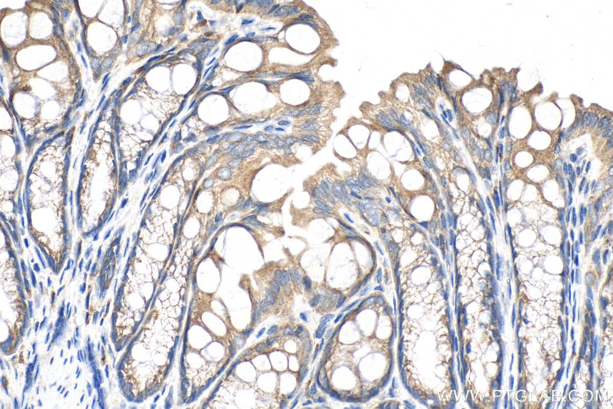 Immunohistochemistry (IHC) staining of mouse colon tissue using AOAH Polyclonal antibody (12911-1-AP)