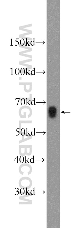 Western Blot (WB) analysis of mouse colon tissue using AOAH Polyclonal antibody (12911-1-AP)