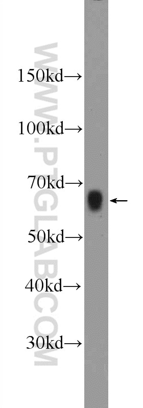 WB analysis of mouse colon using 12911-1-AP