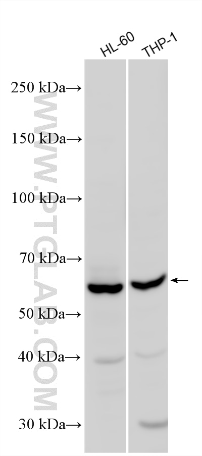Western Blot (WB) analysis of various lysates using AOAH Polyclonal antibody (12911-1-AP)