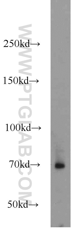 WB analysis of mouse spleen using 12911-1-AP