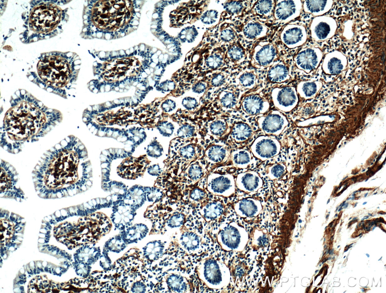 Immunohistochemistry (IHC) staining of human small intestine tissue using VAP1 Polyclonal antibody (14365-1-AP)