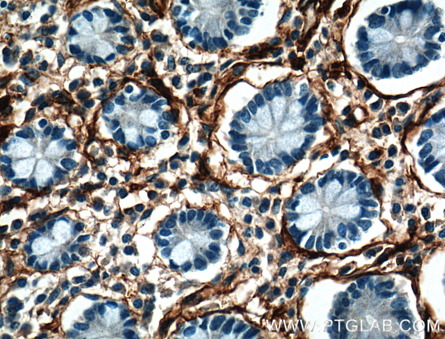 IHC staining of human small intestine using 14365-1-AP