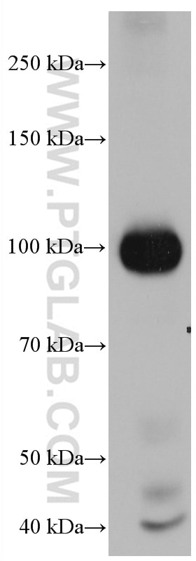 Western Blot (WB) analysis of human ileum tissue using AOC3 Monoclonal antibody (66834-1-Ig)