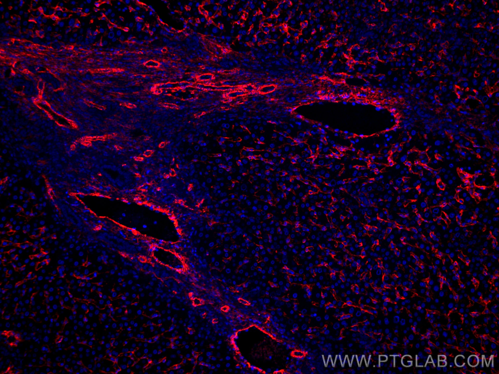 IF Staining of human liver cancer using CL594-66834