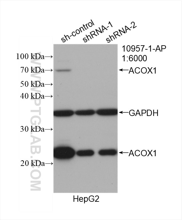 Western Blot (WB) analysis of HepG2 cells using ACOX1 Polyclonal antibody (10957-1-AP)