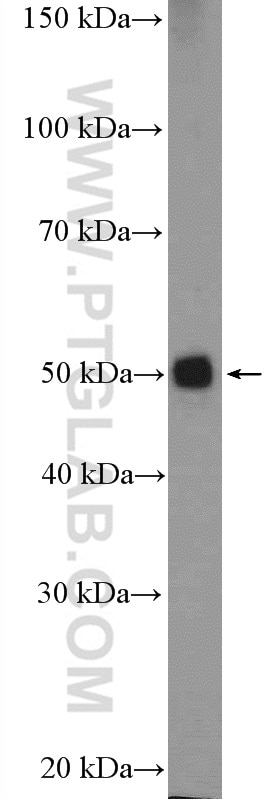 Western Blot (WB) analysis of mouse kidney tissue using ACOX1 Polyclonal antibody (10957-1-AP)