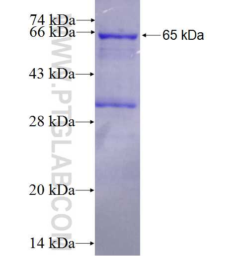 AOX fusion protein Ag1405 SDS-PAGE