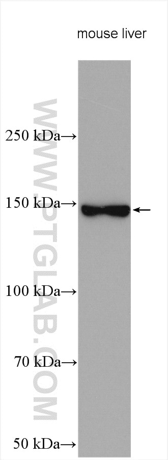 Western Blot (WB) analysis of various lysates using Aldehyde oxidase Polyclonal antibody (19495-1-AP)