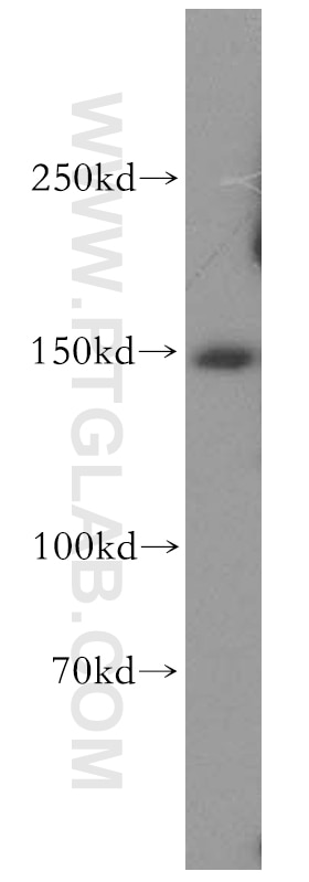 Western Blot (WB) analysis of mouse lung tissue using Aldehyde oxidase Polyclonal antibody (19495-1-AP)