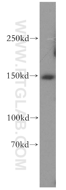 WB analysis of mouse lung using 19495-1-AP