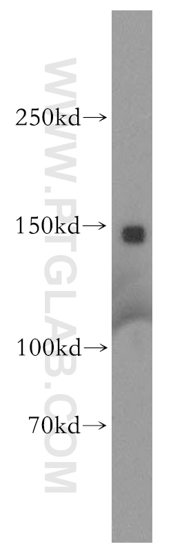 Western Blot (WB) analysis of mouse pancreas tissue using Aldehyde oxidase Polyclonal antibody (19495-1-AP)