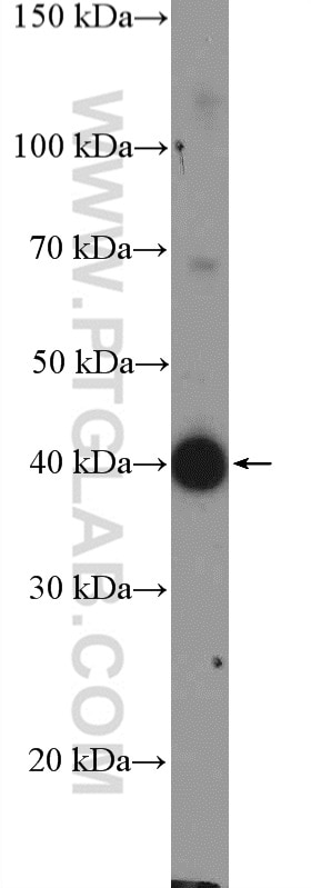 AP1,JUN,P39 Polyclonal antibody