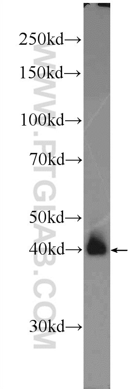 WB analysis of HEK-293 using 22114-1-AP