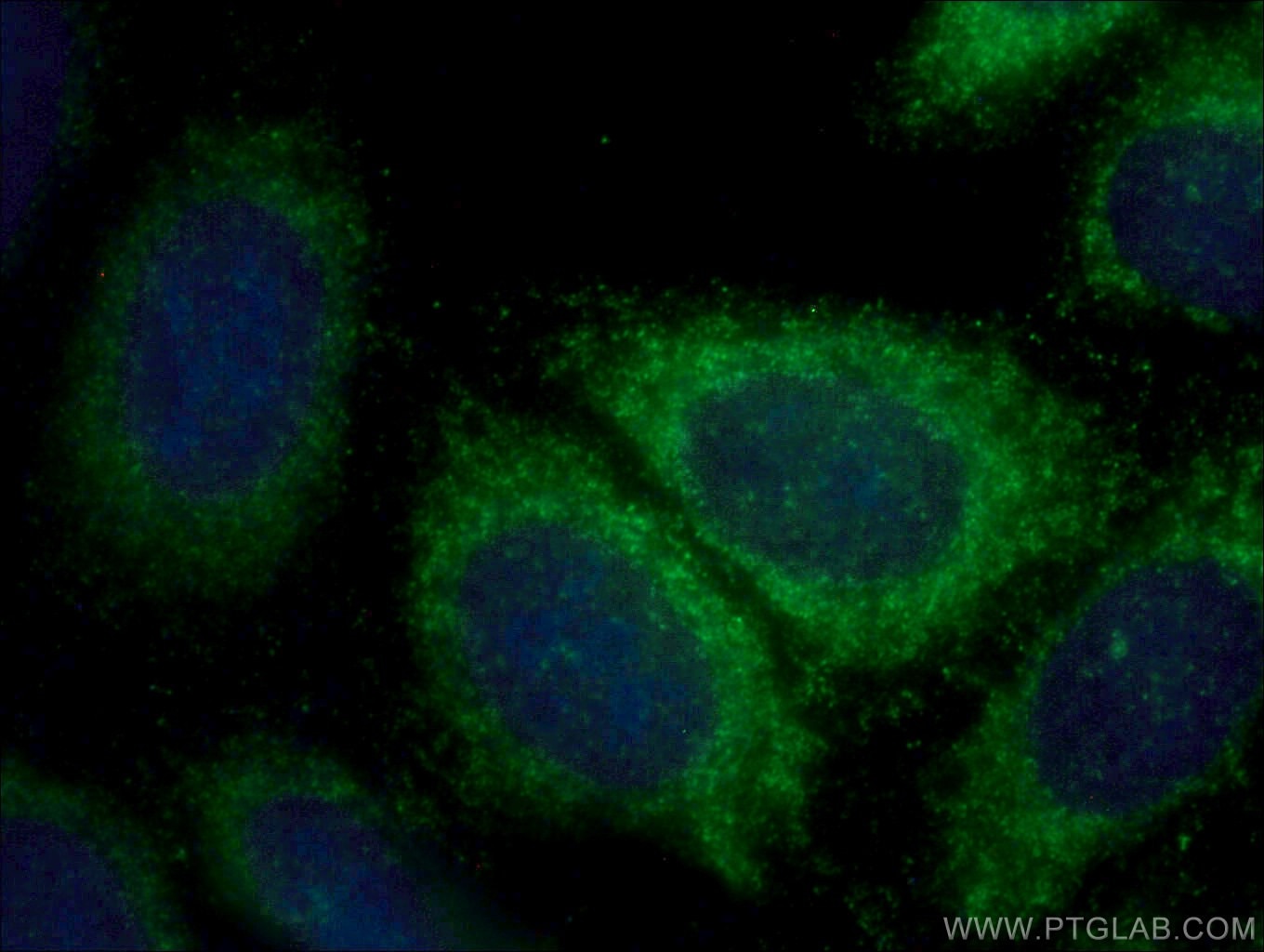 Immunofluorescence (IF) / fluorescent staining of HepG2 cells using AP1B1 Polyclonal antibody (16932-1-AP)