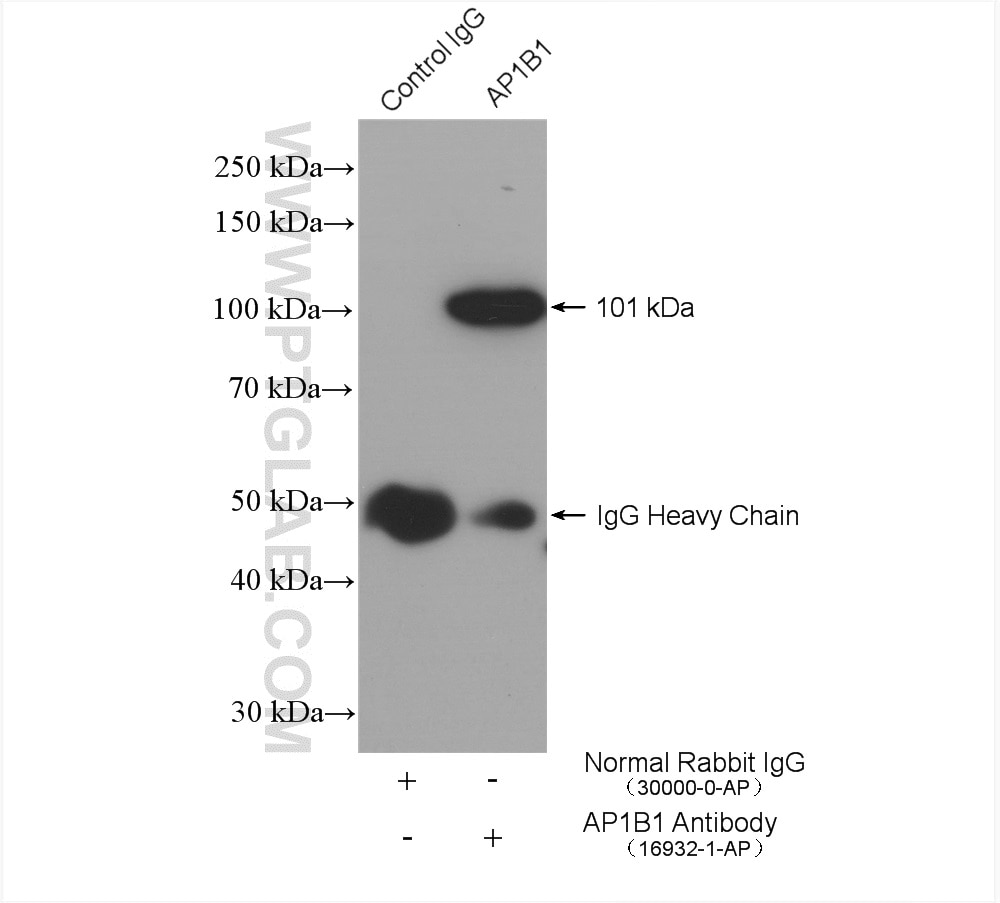 Immunoprecipitation (IP) experiment of HEK-293 cells using AP1B1 Polyclonal antibody (16932-1-AP)