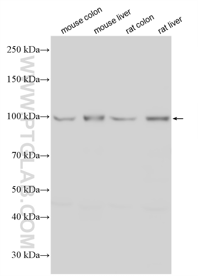 Various lysates were subjected to SDS PAGE followed by western blot with 16932-1-AP (AP1B1 antibody) at dilution of 1:4000 incubated at room temperature for 1.5 hours. Western Blot (WB) analysis of various lysates using AP1B1 Polyclonal antibody (16932-1-AP)
