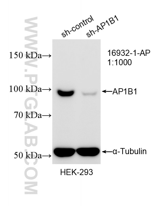 Western Blot (WB) analysis of HEK-293 cells using AP1B1 Polyclonal antibody (16932-1-AP)