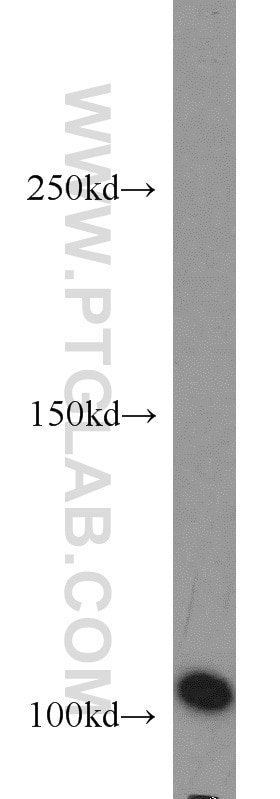 Western Blot (WB) analysis of HEK-293 cells using AP1B1 Polyclonal antibody (16932-1-AP)