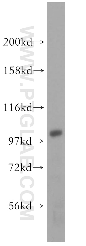 Western Blot (WB) analysis of HEK-293 cells using AP1B1 Polyclonal antibody (16932-1-AP)