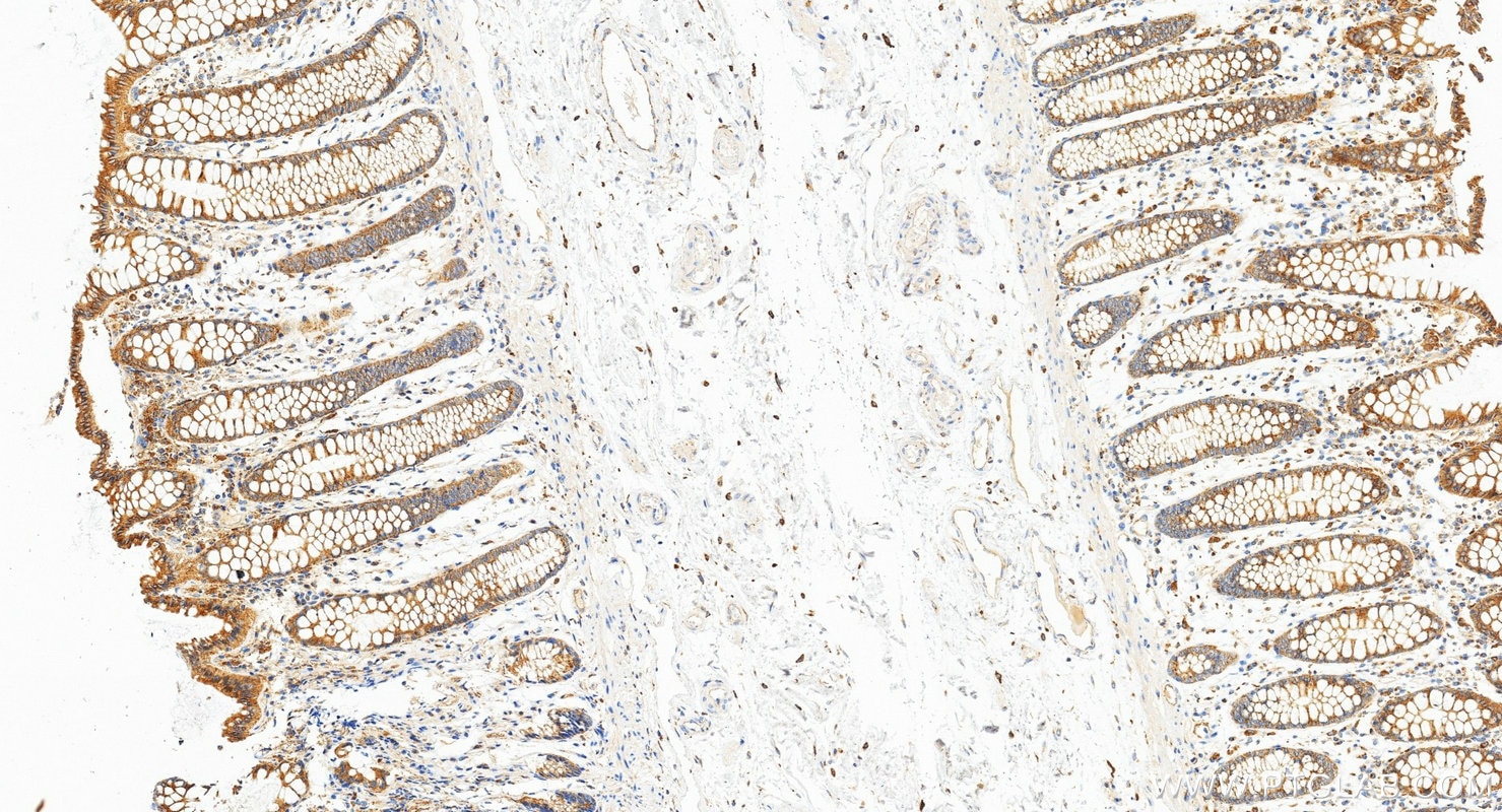 Immunohistochemistry (IHC) staining of human colon tissue using AP1B1 Recombinant monoclonal antibody (87859-1-RR)