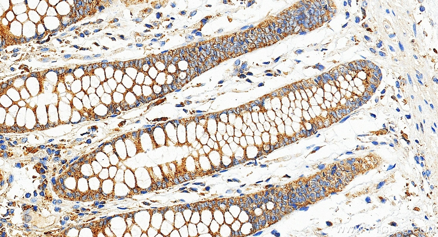 Immunohistochemistry (IHC) staining of human colon tissue using AP1B1 Recombinant monoclonal antibody (87859-1-RR)