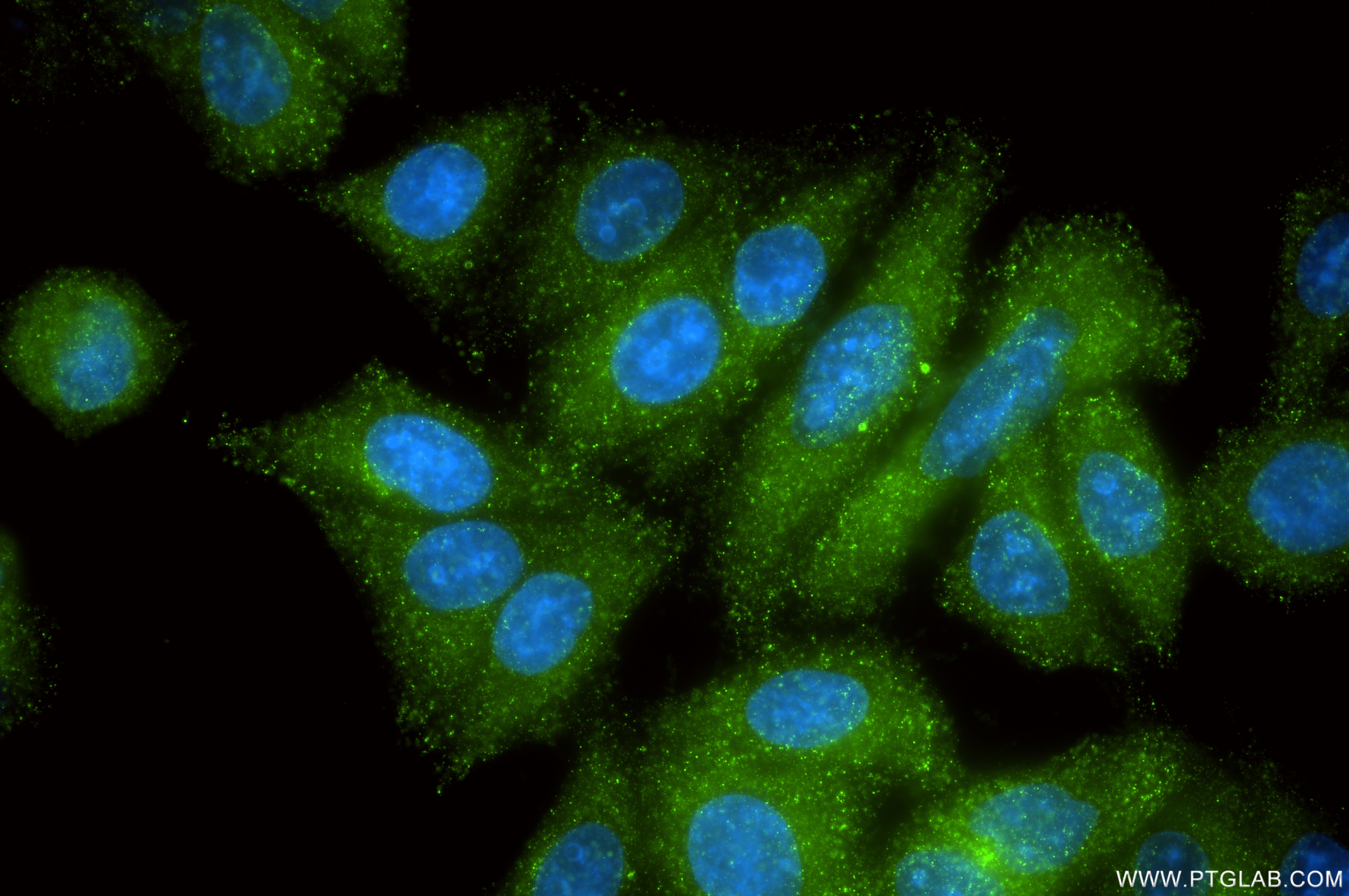 Immunofluorescence (IF) / fluorescent staining of HepG2 cells using AP1B1 Recombinant monoclonal antibody (87859-1-RR)