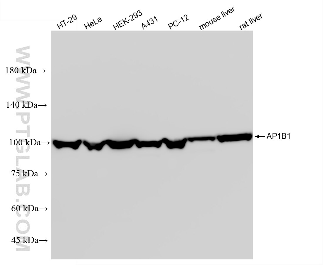 Western Blot (WB) analysis of various lysates using AP1B1 Recombinant monoclonal antibody (87859-1-RR)