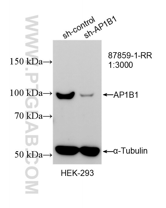 Western Blot (WB) analysis of HEK-293 cells using AP1B1 Recombinant monoclonal antibody (87859-1-RR)
