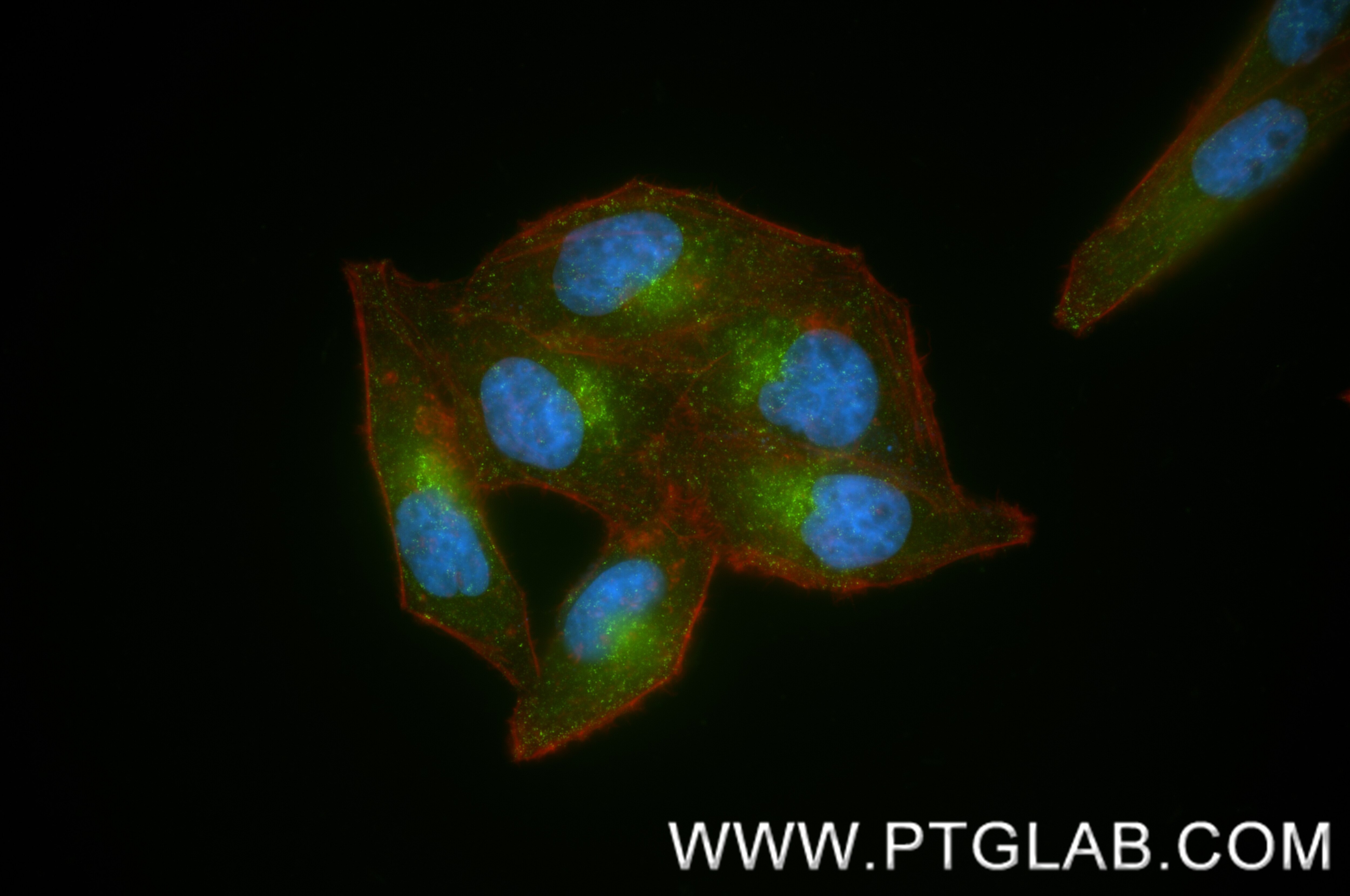 Immunofluorescence (IF) / fluorescent staining of HepG2 cells using AP1B1 Recombinant monoclonal antibody (87859-2-RR)