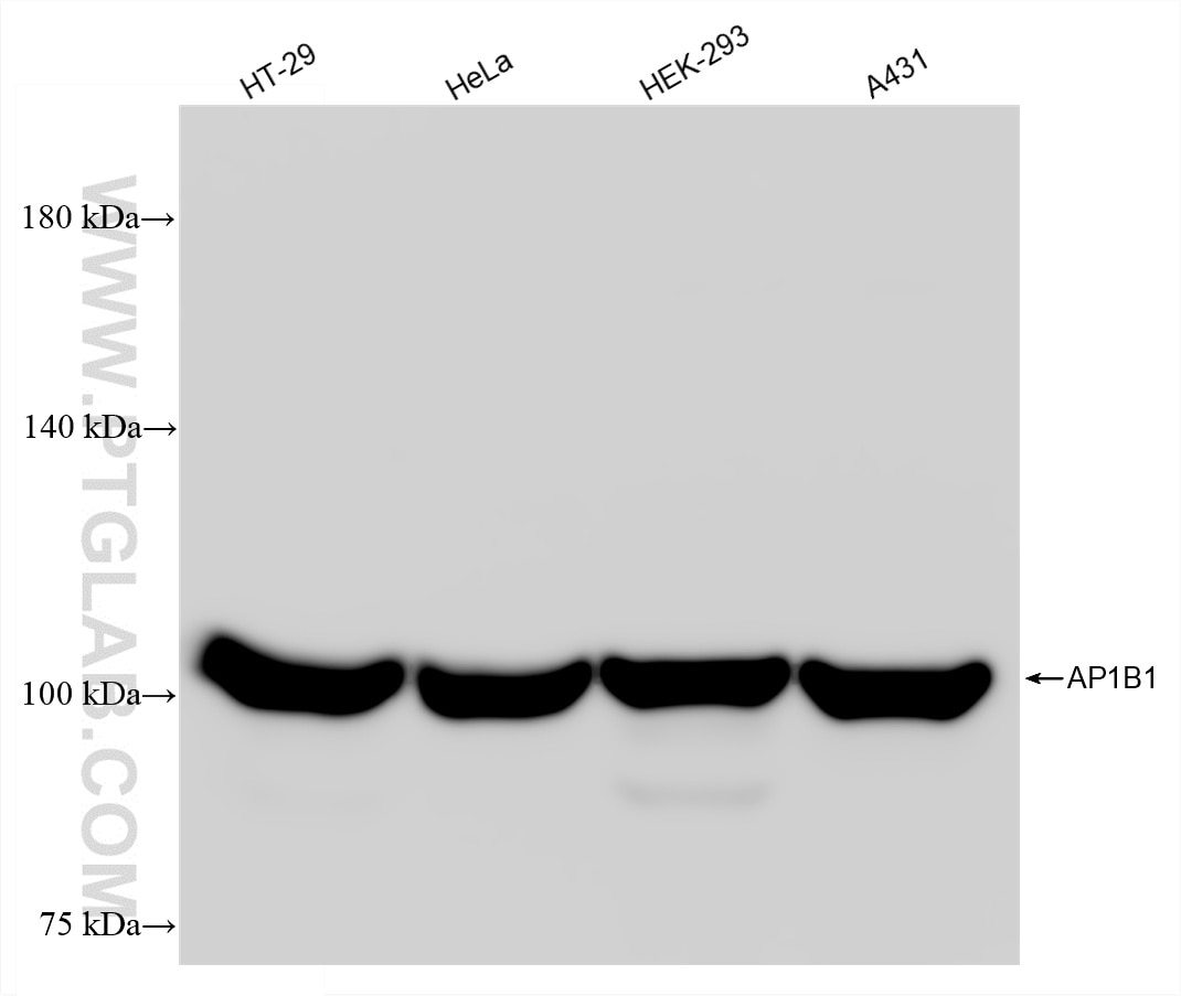 Western Blot (WB) analysis of various lysates using AP1B1 Recombinant monoclonal antibody (87859-2-RR)