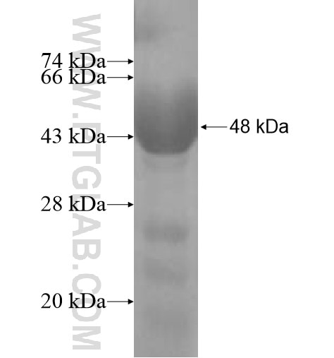 AP1B1 fusion protein Ag10417 SDS-PAGE