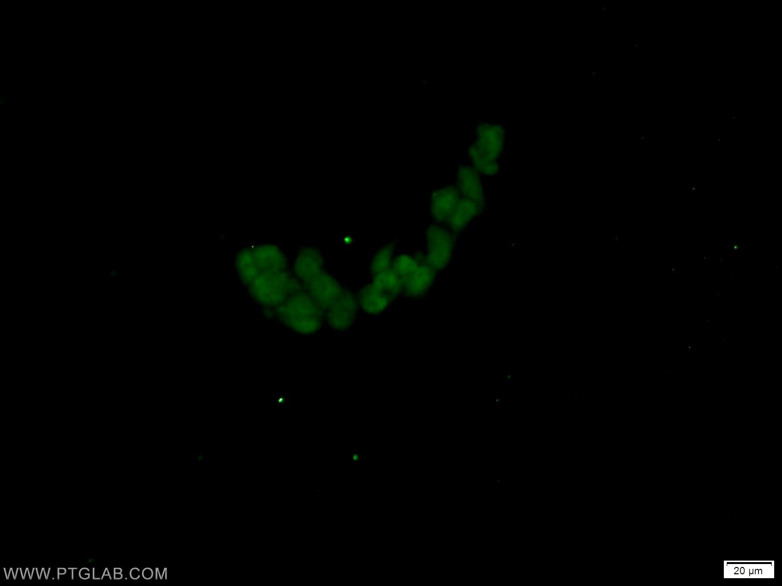 Gamma Adaptin