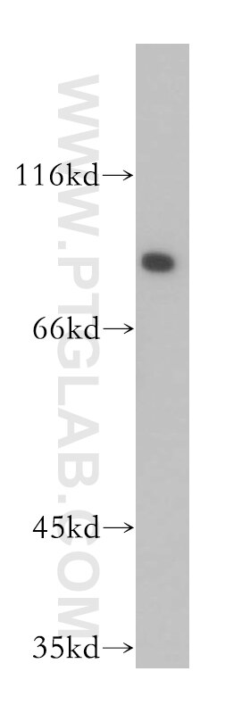 WB analysis of HEK-293 using 13258-1-AP