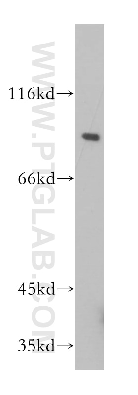 Western Blot (WB) analysis of mouse skeletal muscle tissue using Gamma Adaptin Polyclonal antibody (13258-1-AP)