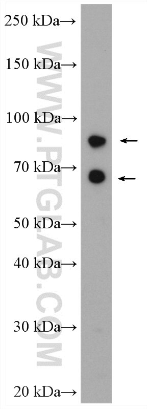 Western Blot (WB) analysis of THP-1 cells using AP1G2 Polyclonal antibody (17907-1-AP)
