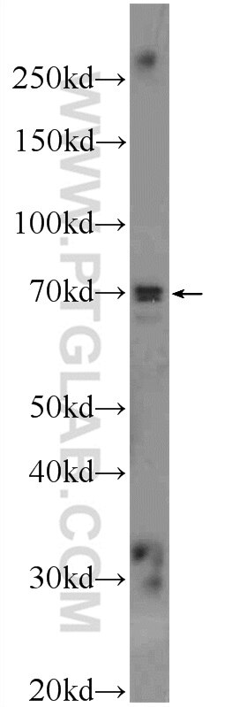 WB analysis of mouse brain using 17907-1-AP