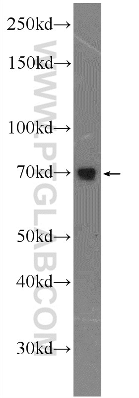 AP1G2 Polyclonal antibody