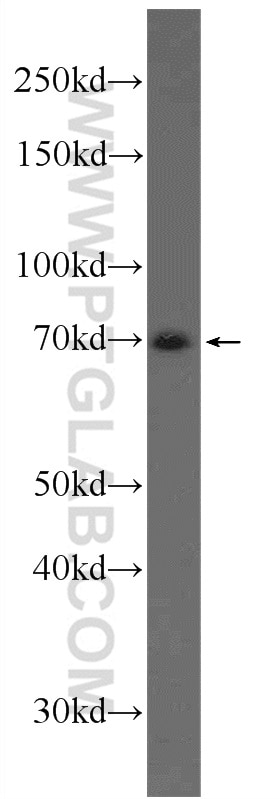 Western Blot (WB) analysis of MCF-7 cells using AP1G2 Polyclonal antibody (17907-1-AP)