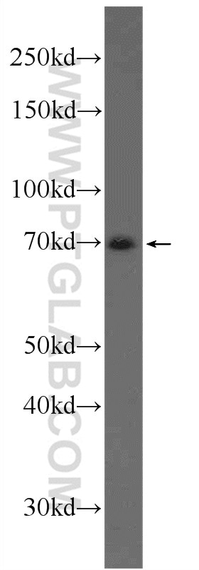 WB analysis of MCF-7 using 17907-1-AP