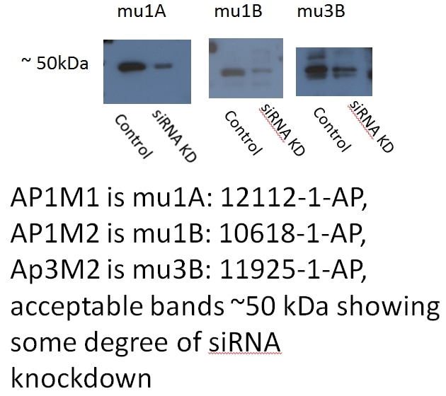 Western Blot (WB) analysis of Hacat cells using AP1M1 Polyclonal antibody (12112-1-AP)