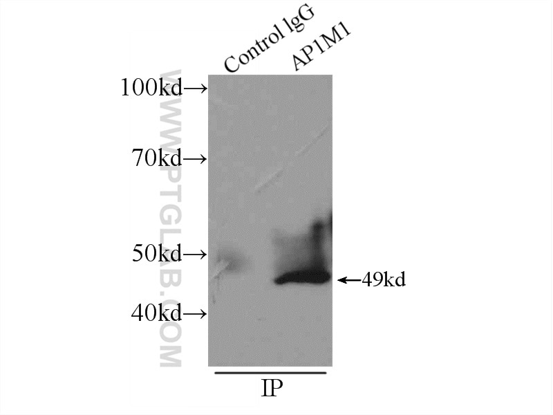 Immunoprecipitation (IP) experiment of SH-SY5Y cells using AP1M1 Polyclonal antibody (12112-1-AP)