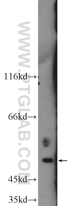 Western Blot (WB) analysis of rat brain tissue using AP1M1 Polyclonal antibody (12112-1-AP)