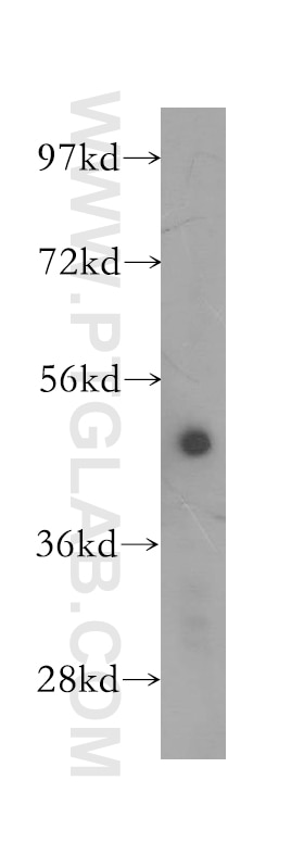 Western Blot (WB) analysis of human brain tissue using AP1M1 Polyclonal antibody (12112-1-AP)