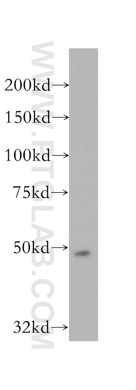 Western Blot (WB) analysis of SH-SY5Y cells using AP1M1 Polyclonal antibody (12112-1-AP)