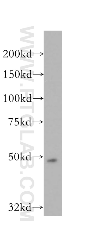 WB analysis of SH-SY5Y using 12112-1-AP